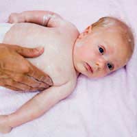 Baby Eczema Eczema Dermatitis