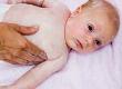 How to Treat Baby Eczema