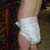Treating Roseola Infantum