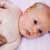 How to Treat Baby Eczema