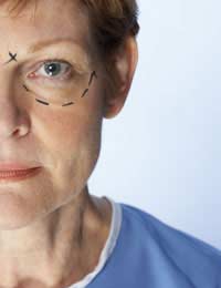 Sagging Skin Loose Facial Muscles